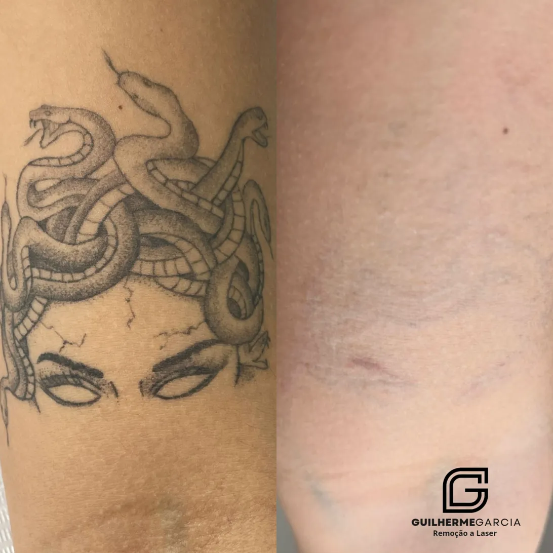 Tatuagem